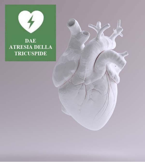 L' ATRESIA DELLA TRICUSPIDE